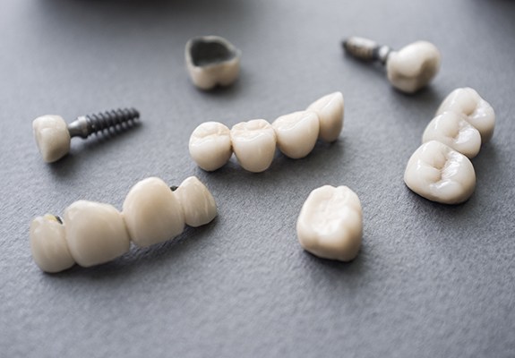 Dental implant restorations prior to placement